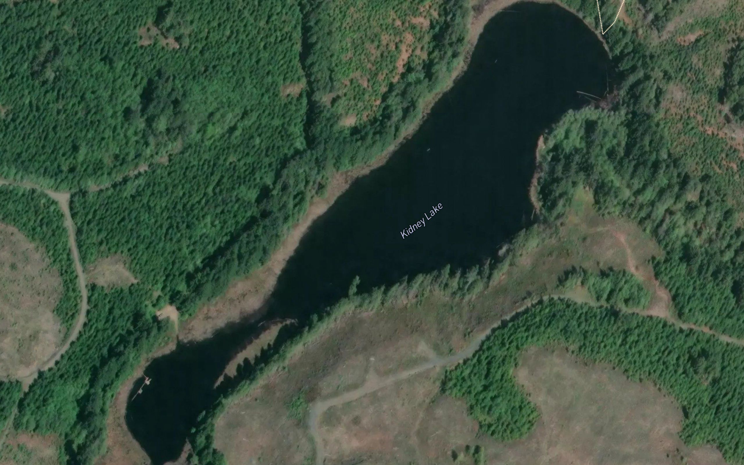 Kidney Lake