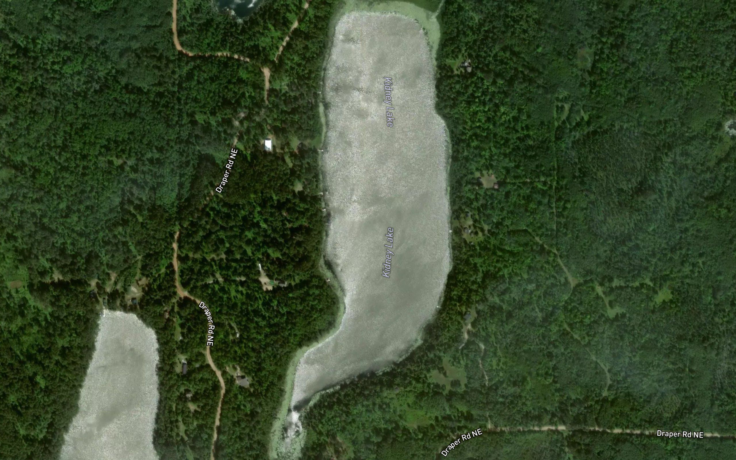 Kidney Lake