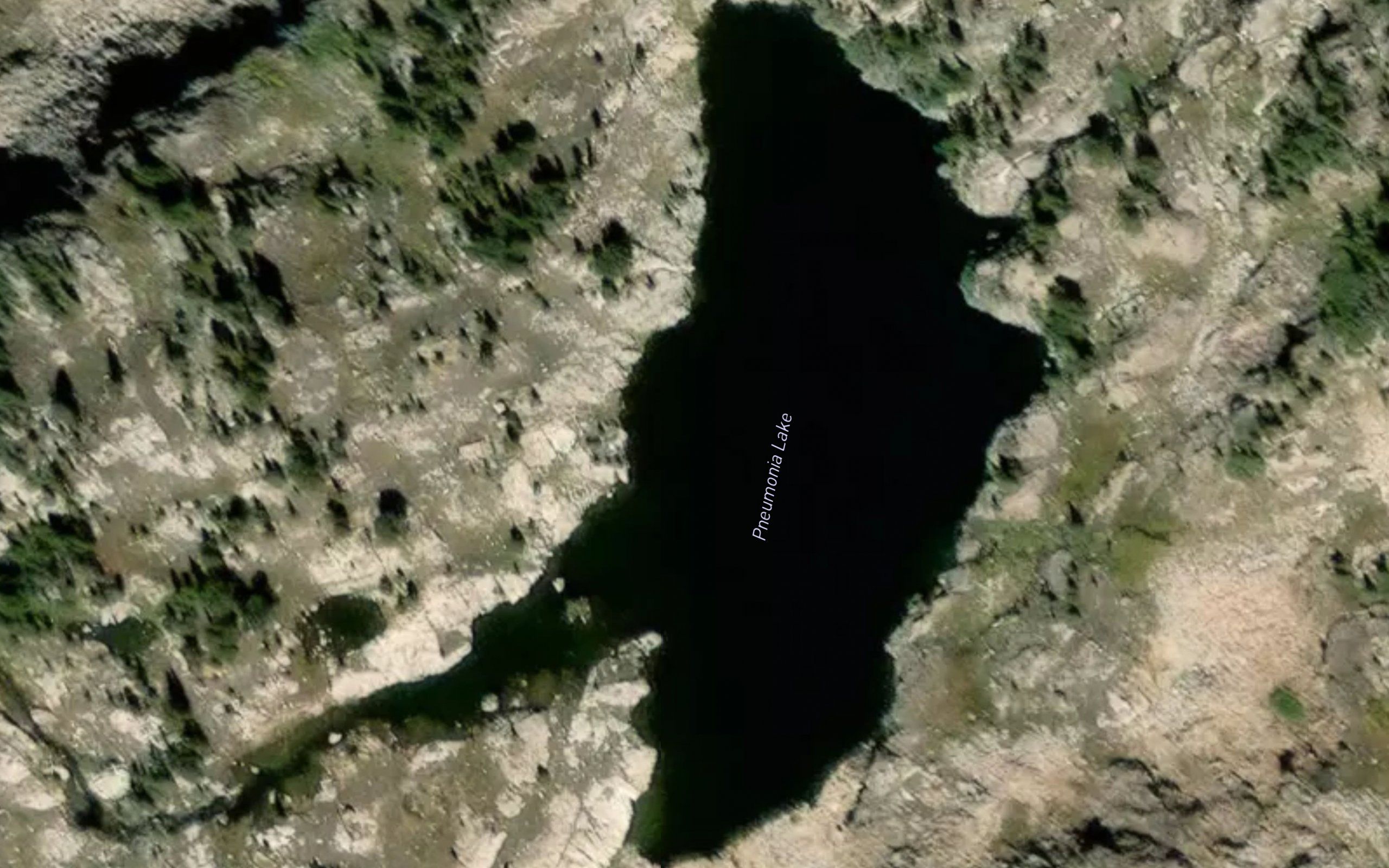 Pneumonia Lake