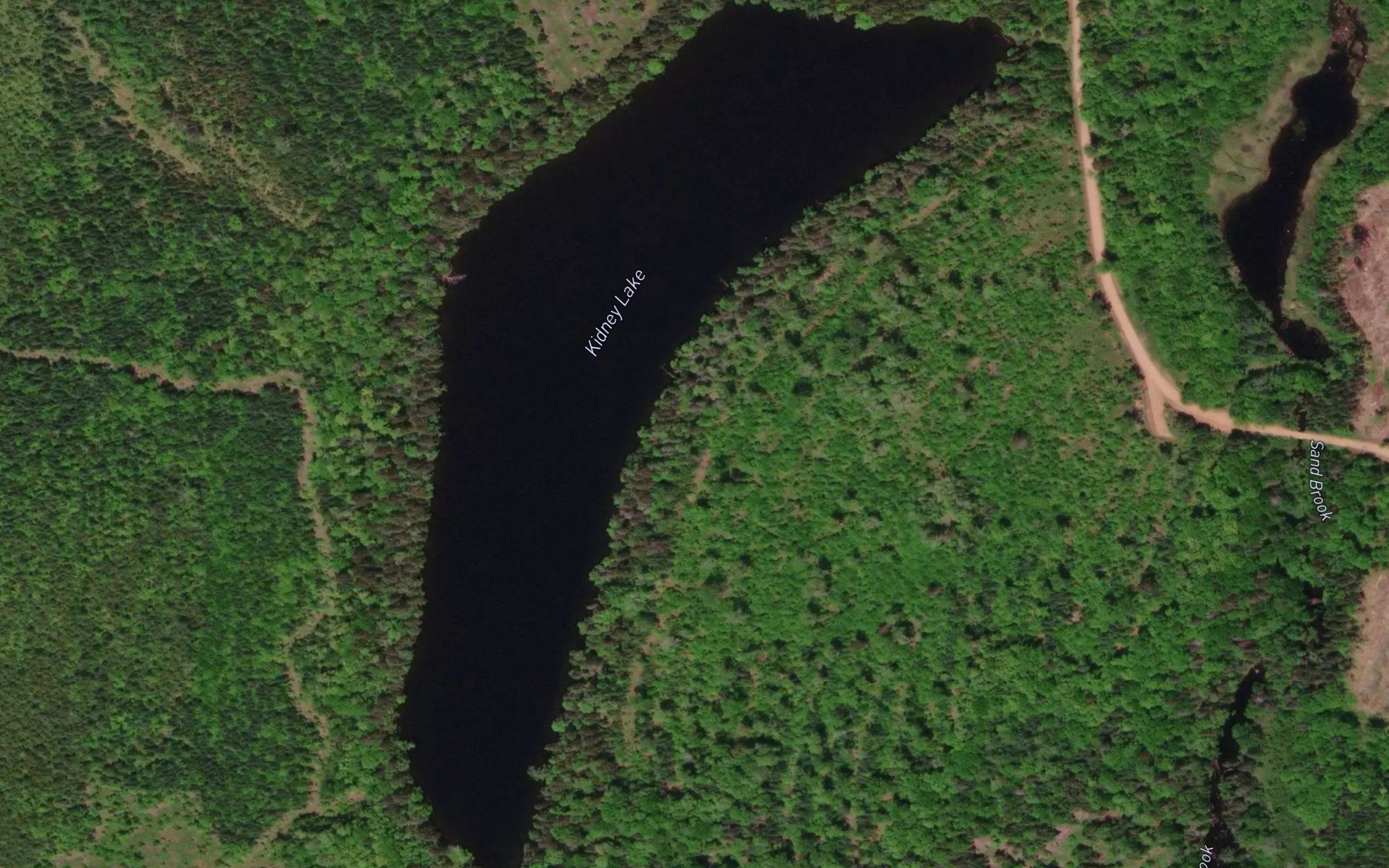 Kidney Lake