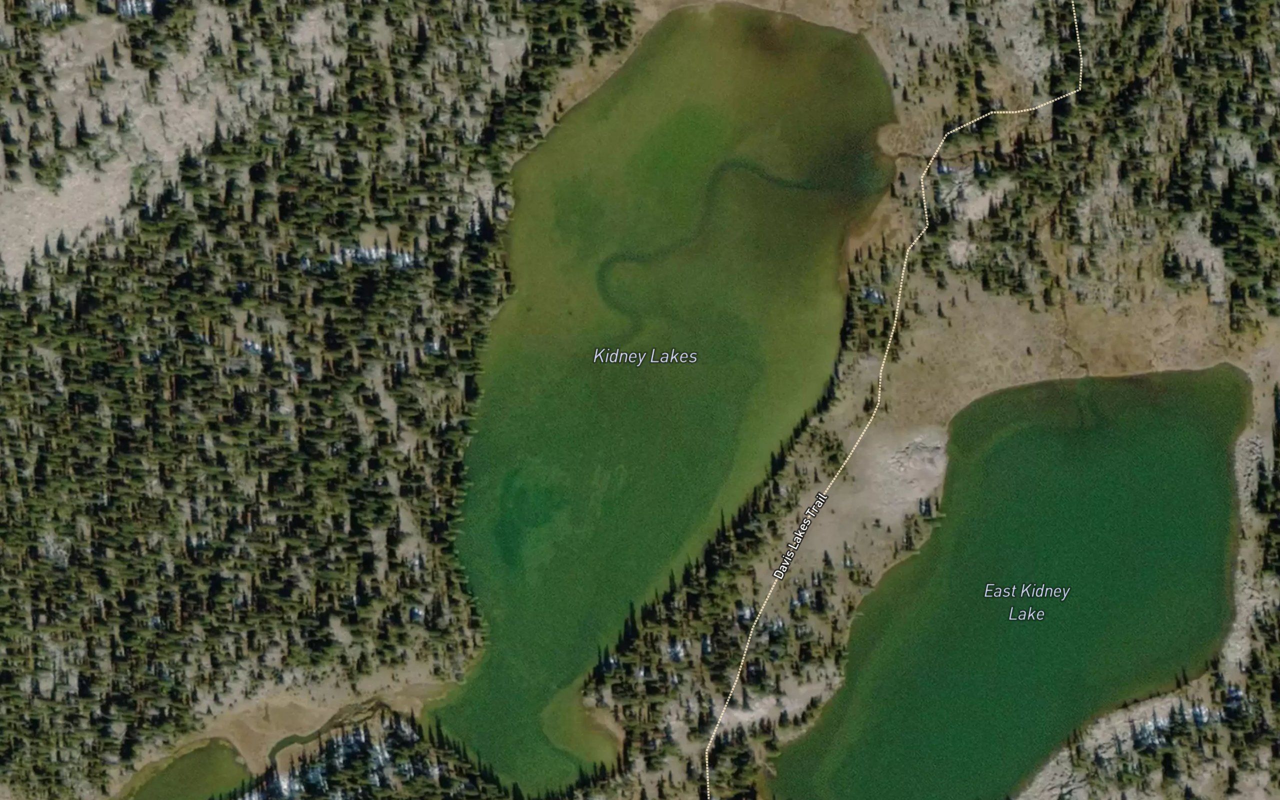 Kidney Lakes