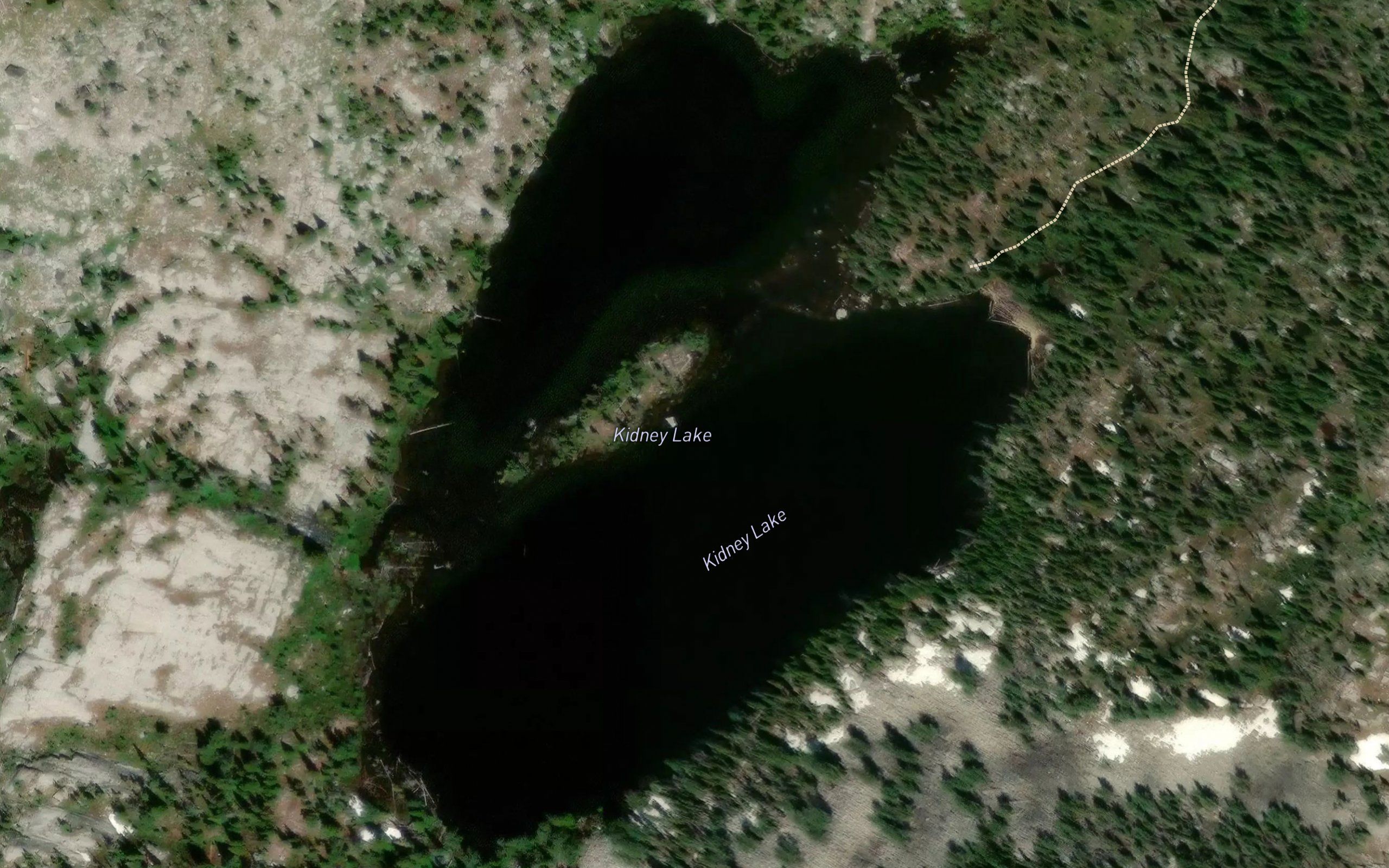 Kidney Lake