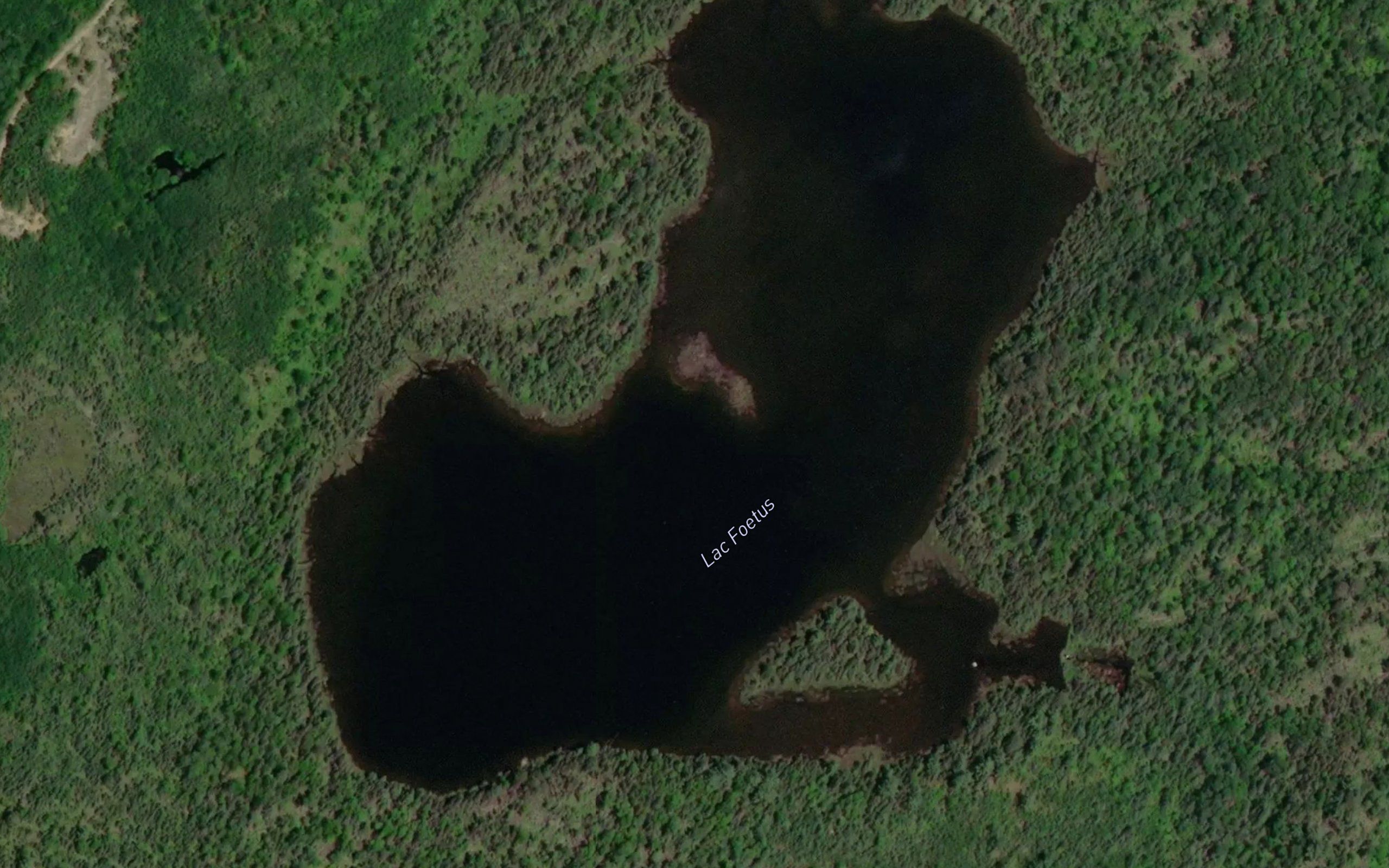 Lac Foetus