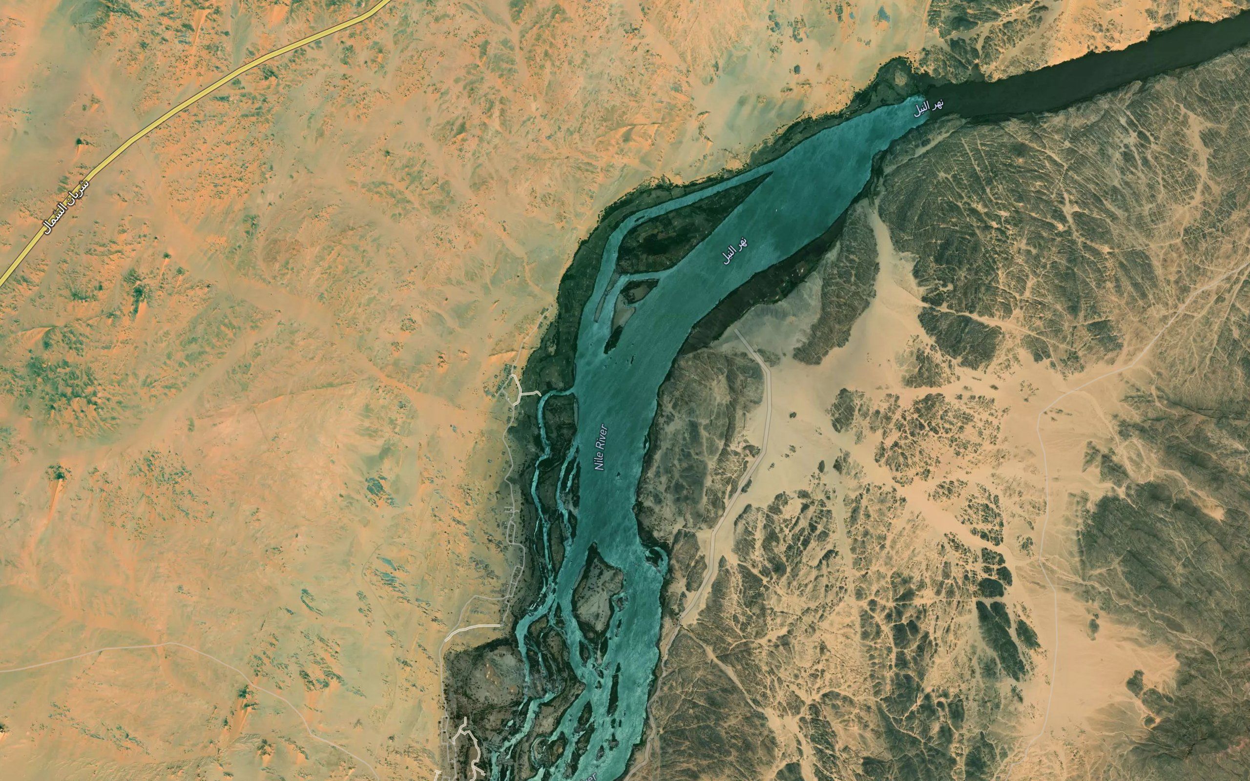 Dal Cataract