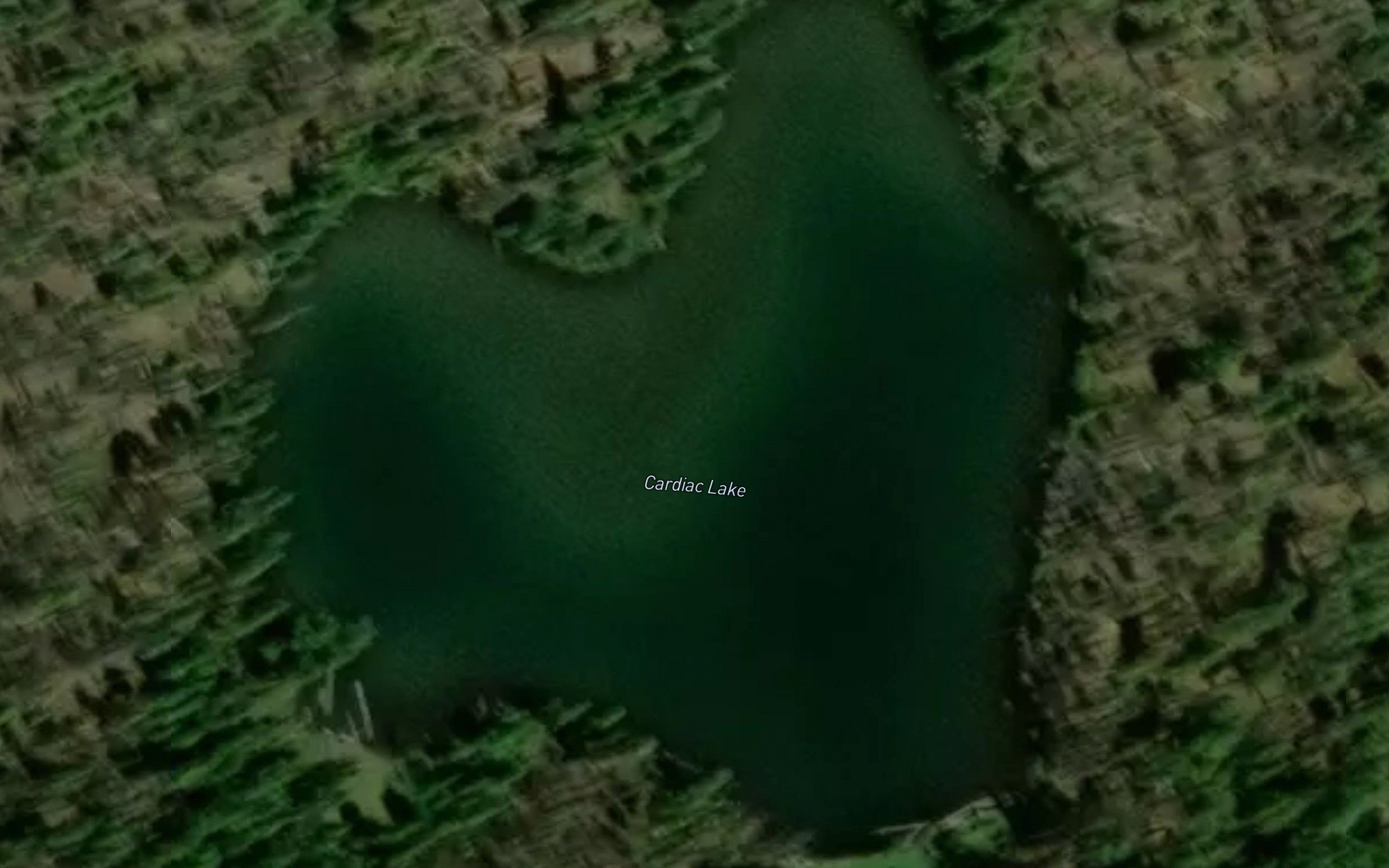 Cardiac Lake